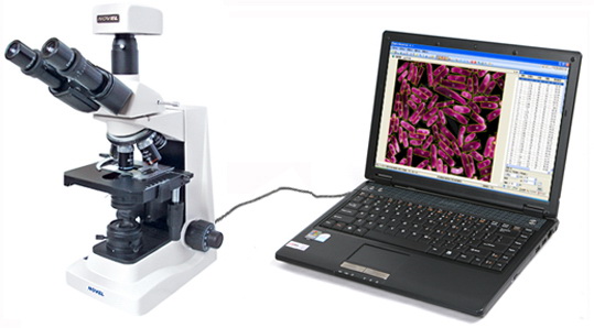 MIA-V�������@΢�D�����ϵ�y(t��ng)